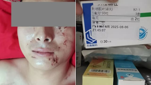 新婚夜被妻子抓伤流血 男子家中发现精神分裂药后提出离婚