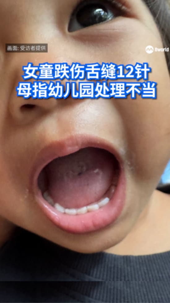 TONGUECUTTT