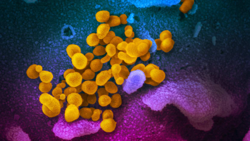 Third Covid-19 antibody treatment in Singapore in the works; human trials likely in coming months