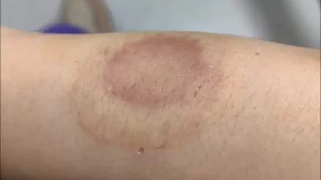 贴纸条提醒邻居别在门口放垃圾 凌晨遭撬锁入屋攻击