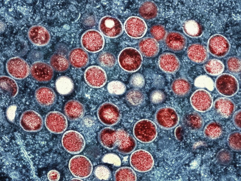 Mpox outbreak in Africa: Immediate risk to Singapore is low, says Health Ministry Mpox outbreak in Africa: Immediate risk to Singapore is low, says Health Ministry