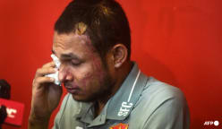 Malaysian footballer acid attack: ‘No further action’ from public prosecutor but police will continue probe