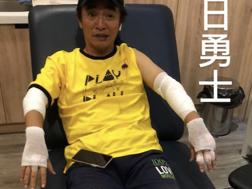 Jacky Wu Crashes Bike While Filming Variety Show; Says His Helmet