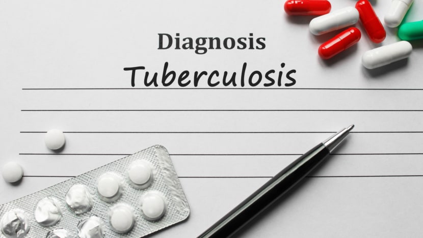 Explainer: Why are there still tuberculosis cases in Singapore and how does the disease spread?