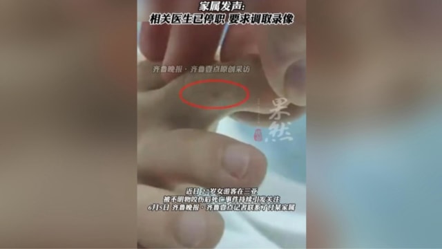 女游客三亚被毒蛇咬伤后死亡 家属要求调取录像