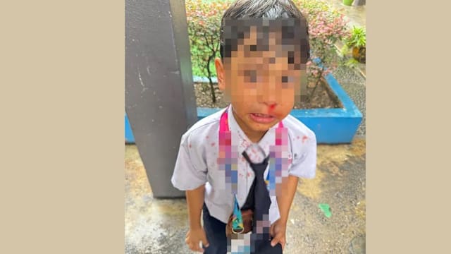 马国七岁童上厕所太慢 遭同学掌掴至鼻子流血