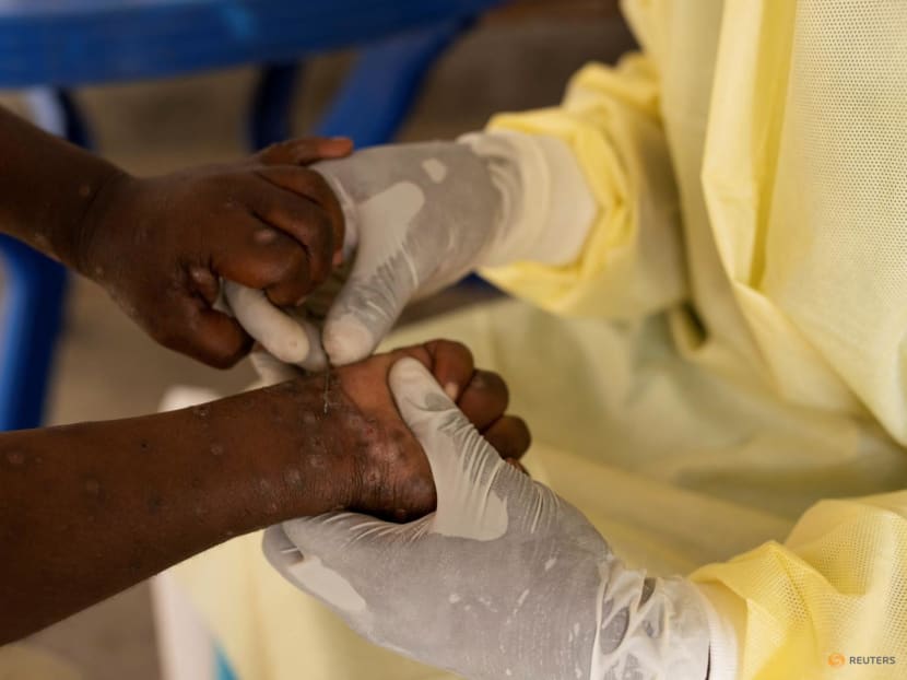 WHO declares mpox a global public health emergency for second time in two years