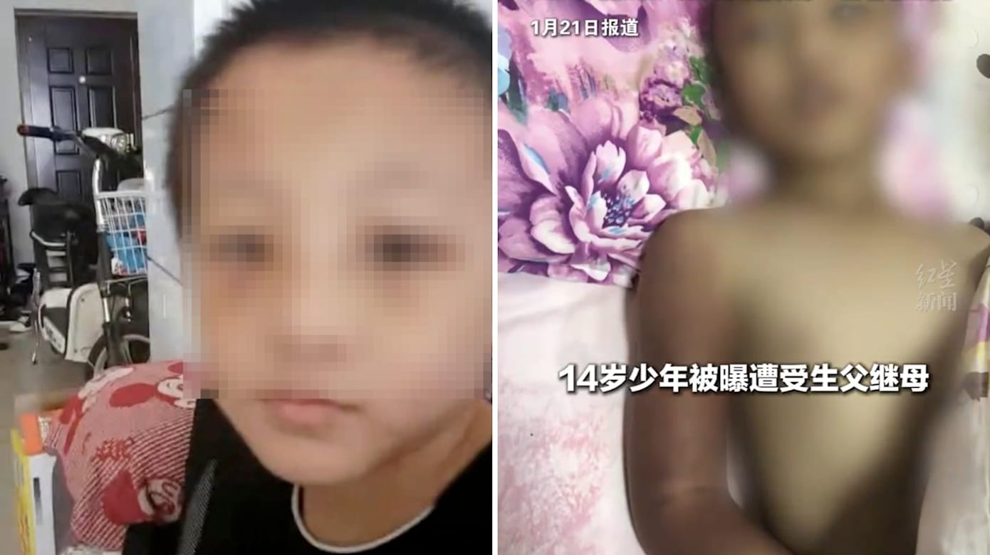 河南14岁男孩疑遭虐待亡 生父自首继母被捕