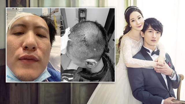 家暴男周永恒爆被二婚妻子欧打　反被指控恐吓被逮捕