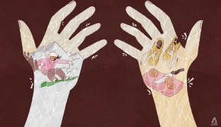 How my eczema taught me that there's no shame in giving up some dreams to take care of myself
