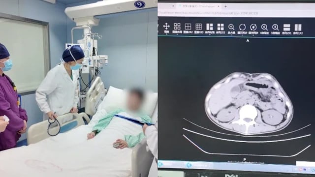 赴泰旅游吃生腌海鲜 上海男子确诊感染阿米巴原虫险丧命