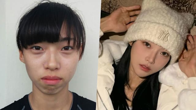 “我哪知道会变这么美！”　“Single's Inferno 5”金珉志亲解整形疑云，压鼻证明没动刀