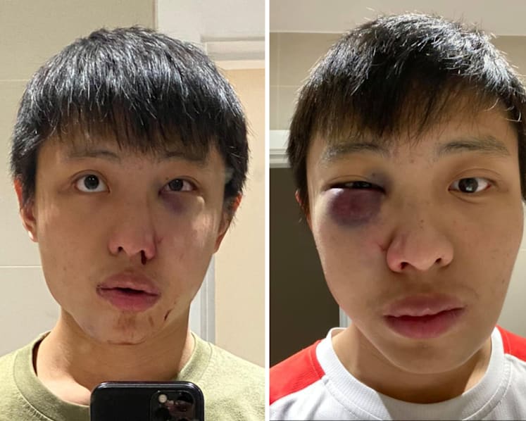 Singapore High Commission 'deeply disturbed' by alleged racist assault on student in London