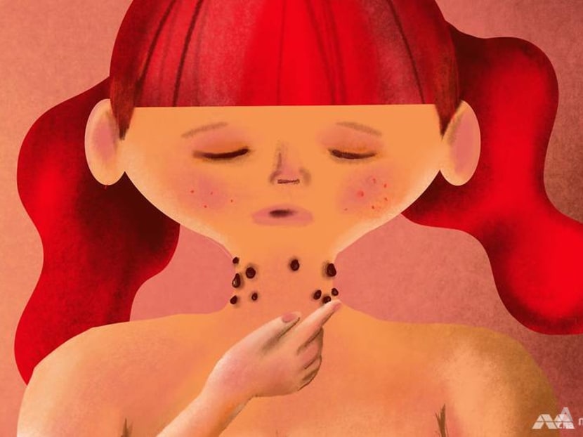 What are those bits of hanging skin on your body? And how do you get rid of them?