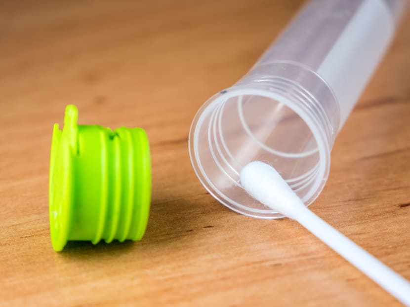 Self-test kits for the human immunodeficiency virus issued under a national programme will take about 20 to 40 minutes to show results after collecting an oral specimen with a swab.