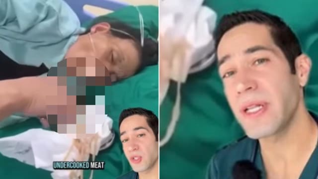 女子口中拉出超长寄生虫 美麻醉师警告吃猪肉要煮熟