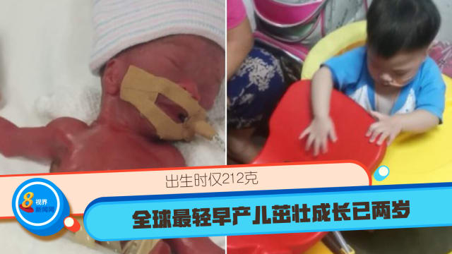 出生时仅212克 全球最轻早产儿茁壮成长已两岁