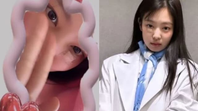 BLACKPINK Jennie首晒“破相脸”　粉丝吓坏，更心疼！