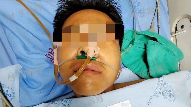 误食野生菌中毒  四川一家四口送院抢救  一人身亡