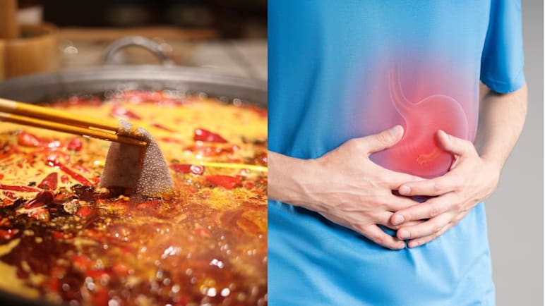 Can stress really cause stomach ulcers? What about spicy food and coffee?