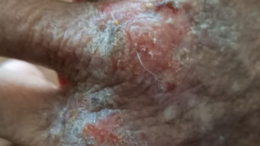 Related article image