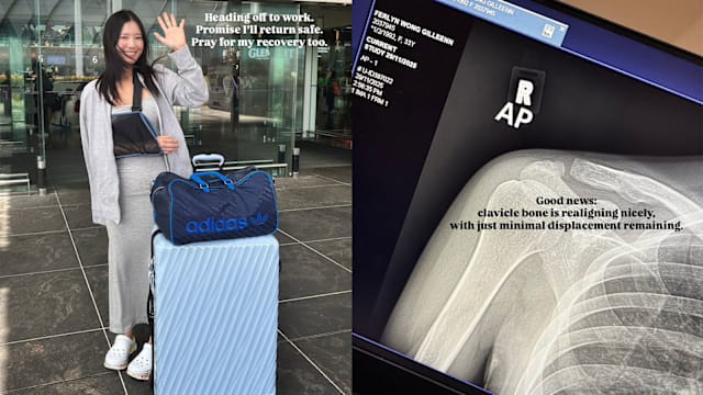 黄晶玲锁骨康复进度乐观　X光显示移位轻微，盼6周后拆吊带