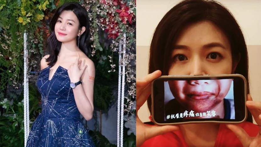 Michelle Chen Was Raising Awareness For Abused Children But Got Slammed For Editing Her Photos Instead Michelle Chen Was Raising Awareness For Abused Children But Got Slammed For Editing Her Photos Instead