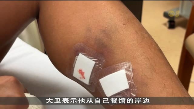 圣淘沙岛居民遭三只水獭袭击 被咬伤手脚