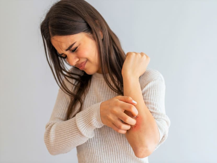 5 common mistakes to avoid if you want to keep eczema at bay 5 common mistakes to avoid if you want to keep eczema at bay