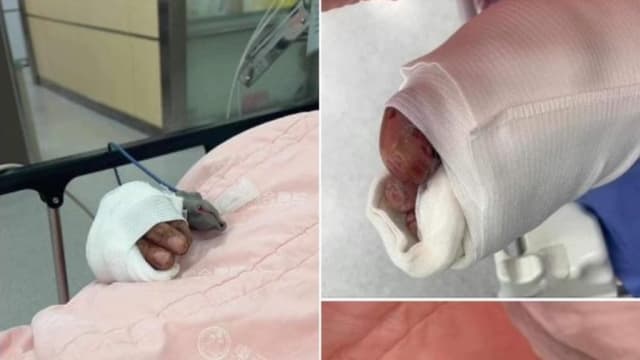 台湾父带女吃宵夜被砍  神秘女大喊“砍错人”救他一命