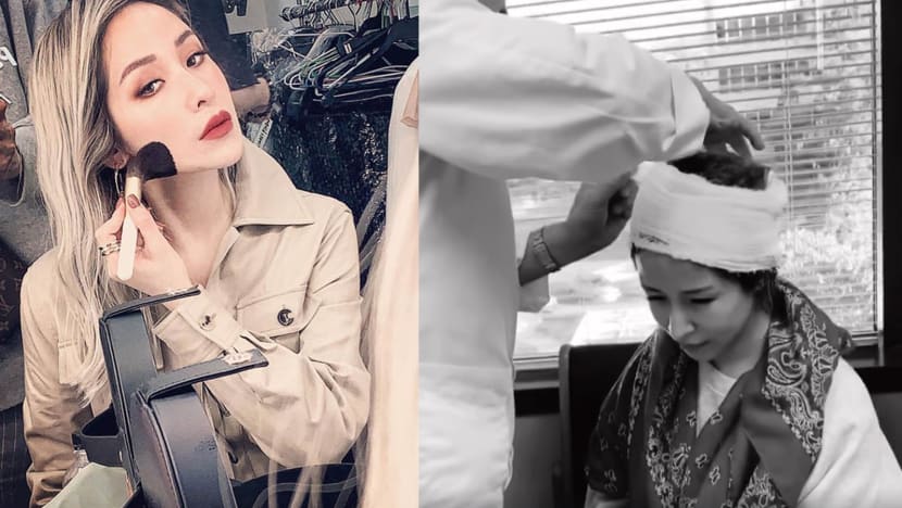 Elva Hsiao Says Recovering From Her Traumatic Head Injury Is Like Returning From "The Gates Of Hell"