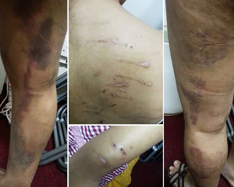 25 months’ jail for employer who beat maid with metal poles and hanger in multiple assaults