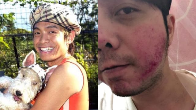 听到大炳被诬蔑　小炳火大“跟陌生人打起来”
