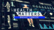 Breast Cancer