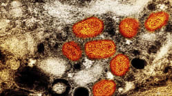 Related article image