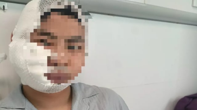 花钱体验海洋馆项目 中国男子竟遭3米长鲨鱼咬伤头部