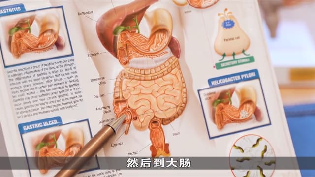 狮城有约 | 患上阑尾炎有什么症状？