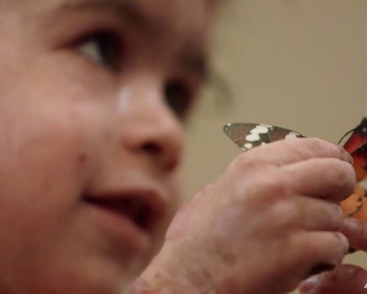 Singapore’s butterfly children, born with ‘the worst disease you’ve never heard of’