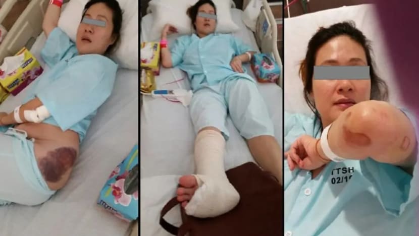 Wanita saman PUB S$5 juta selepas terjatuh ke dalam lurang