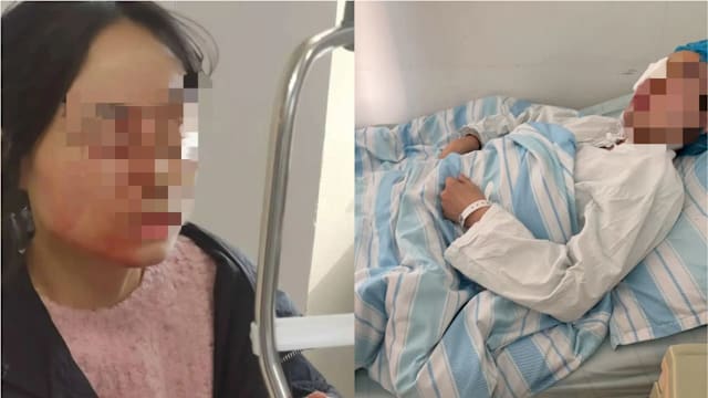劝架反被学生戳伤眼球 浙江女教师血溅教室