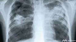 Related article image