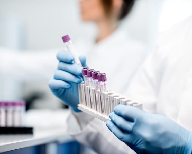 Commentary: Your leftover blood samples are valuable to science – but they are often discarded