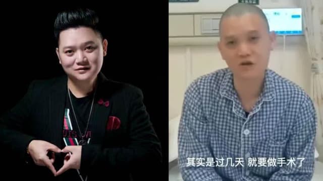 与口腔癌搏斗6年　中国36岁歌手病逝