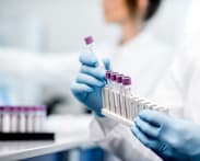 Commentary: Your leftover blood samples are valuable to science – but they are often discarded