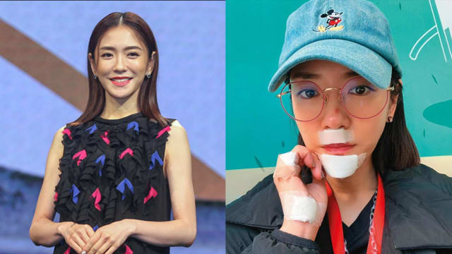 杨千霈走路不小心重摔　脸撞水泥地严重破相！