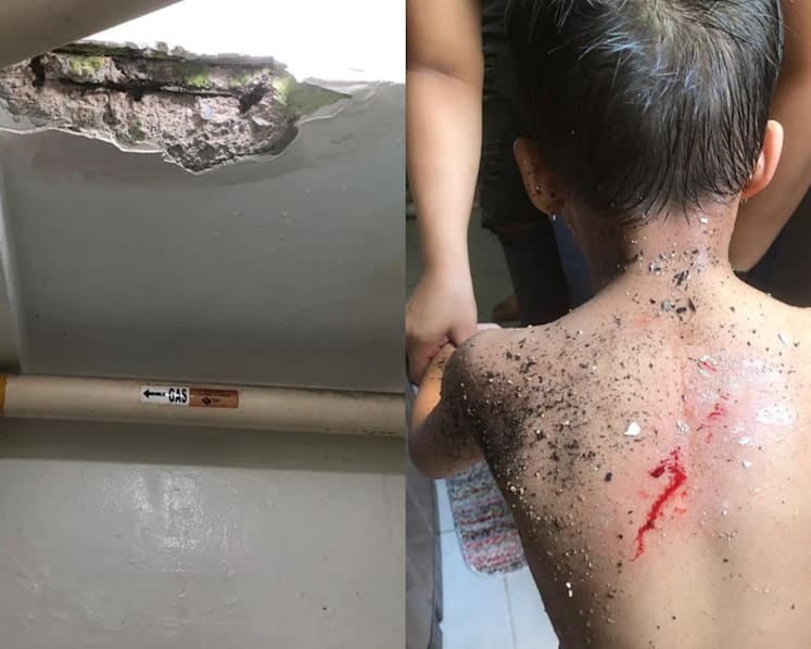 Boy hurt after parts of ceiling fell on him while in bathroom