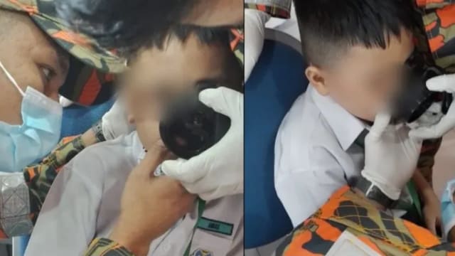 马国男童嘴唇卡瓶盖 消拯员花一小时助脱困