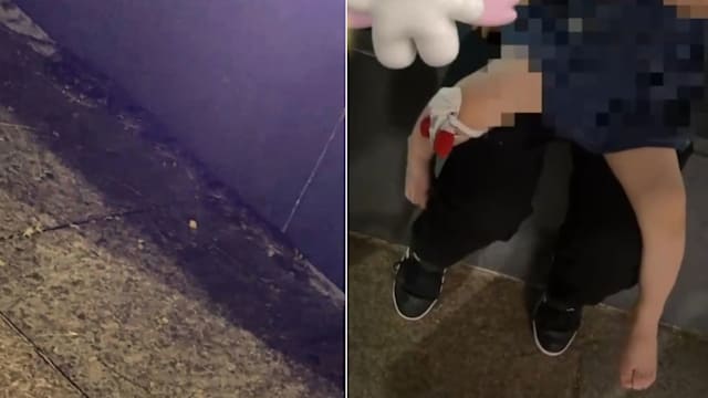 亚洲文明博物馆外散步 两岁女童遭蟒蛇咬伤哭送院