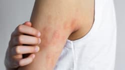 Related article image