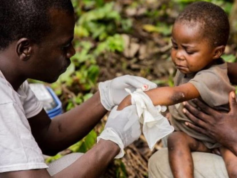 Commentary: Vigilance, not universal smallpox vaccination, needed against monkeypox Commentary: Vigilance, not universal smallpox vaccination, needed against monkeypox